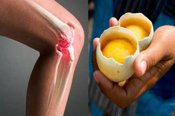 2 eggs only: Eliminate knee and joint pain with this natural treatment