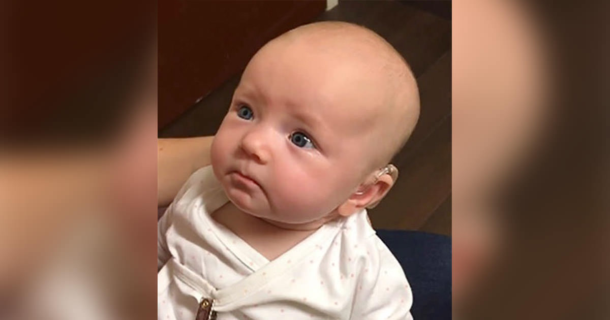 A deaf baby heard Mom say 'I love you' for the first time. Seconds later, the whole internet began to cry