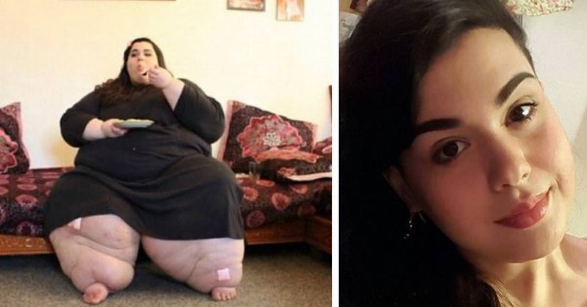 A 24-year-old has weighted 600 lbs. Now watch her amazing transformation after she lost 400 lbs