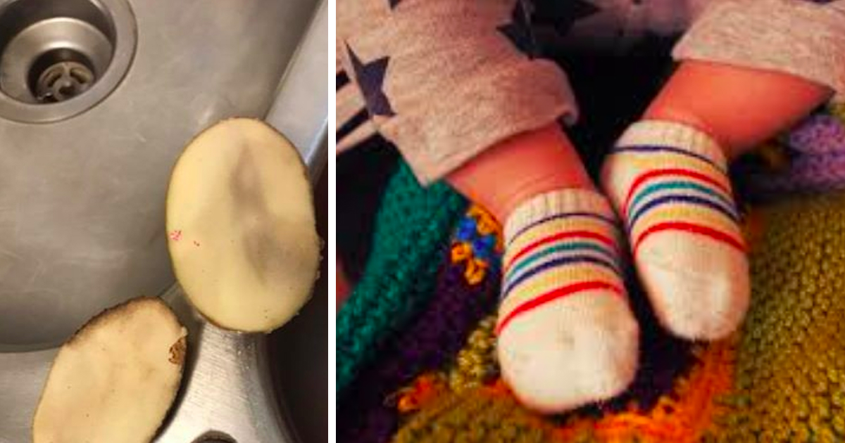 A mother put potatoes inside her sick baby's socks, the next day she shared what they look like on her social network