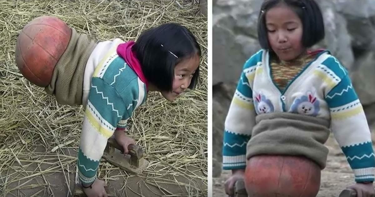 The 'basketball girl' lost her legs in a horrific accident - 10 years later she's a millionaire and this is what she looks like