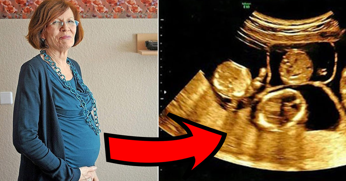 A 65-year-old with 13 children and 7 grandchildren asked for an ultrasound, doctors discovered something they never seen before