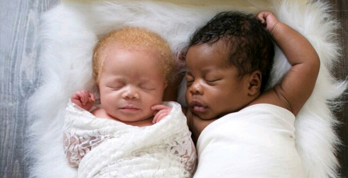 A photographer gave birh to twins - one black and one albino, and the pictures she takes of them are just amazing!