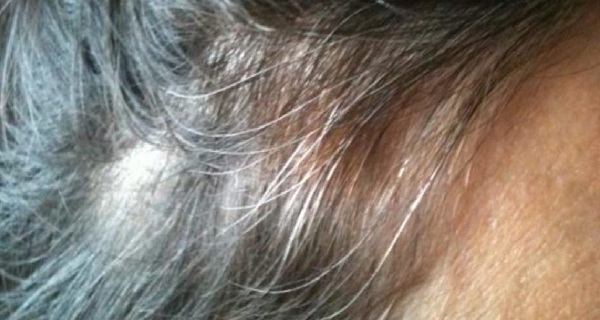 I tried this with my 62-year-old mother, and all her gray hair disappeared! It's so easy and very cheap!