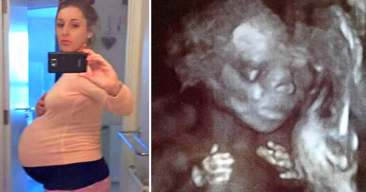 A couple used a 21-year-old surrogate mother, but when they saw her ultrasound.. they were speechless