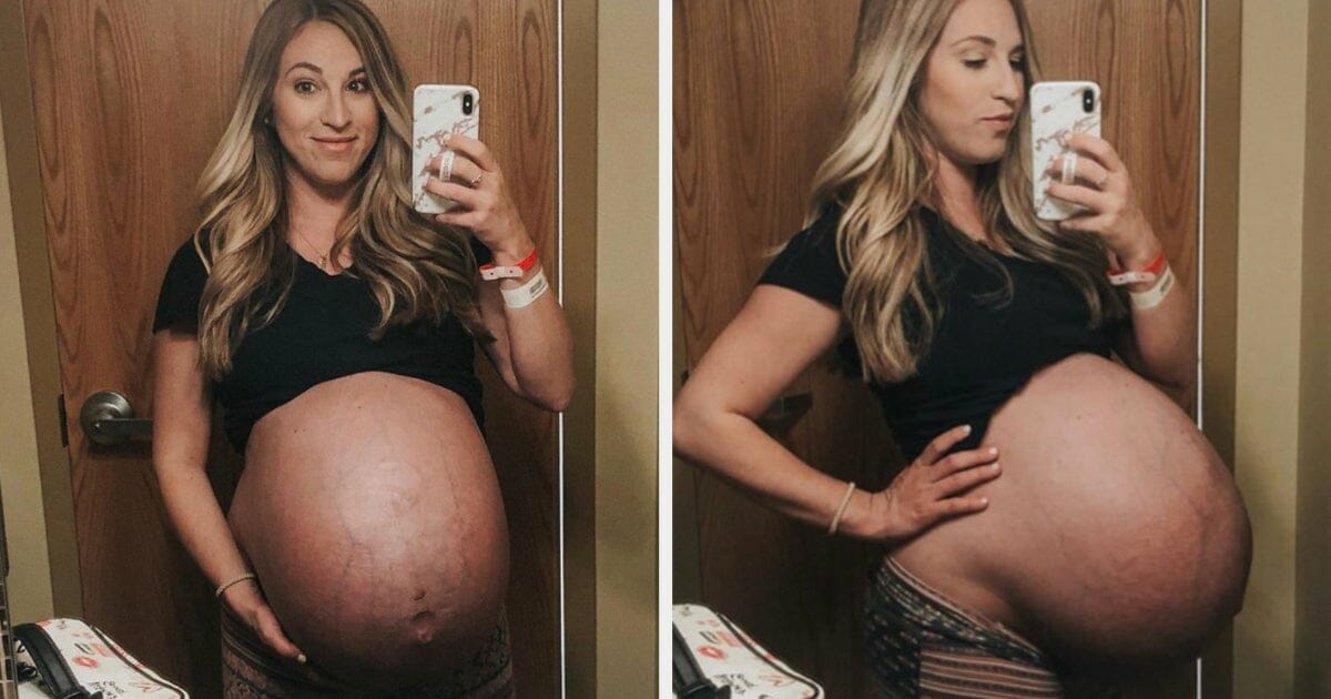 The before and after photos of the pregnant belly with the quadruplets show how amazing a woman's body is