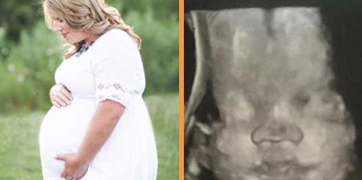 At her husband's funeral she showed she was pregnant - 25 weeks later, doctors revealed a miracle