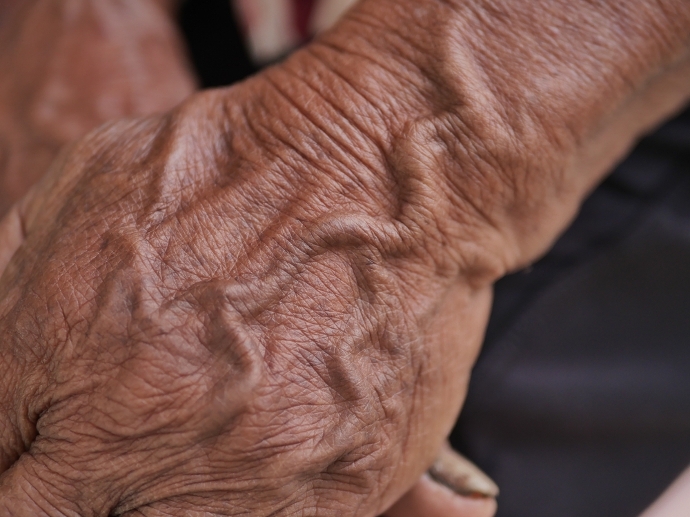 If you see someone with prominent veins - you must tell them these things!