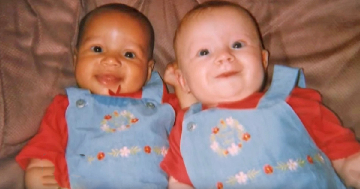 Nobody understood how a mother's twin daughters were born with different skin colors - 18 years later, the truth was revealed