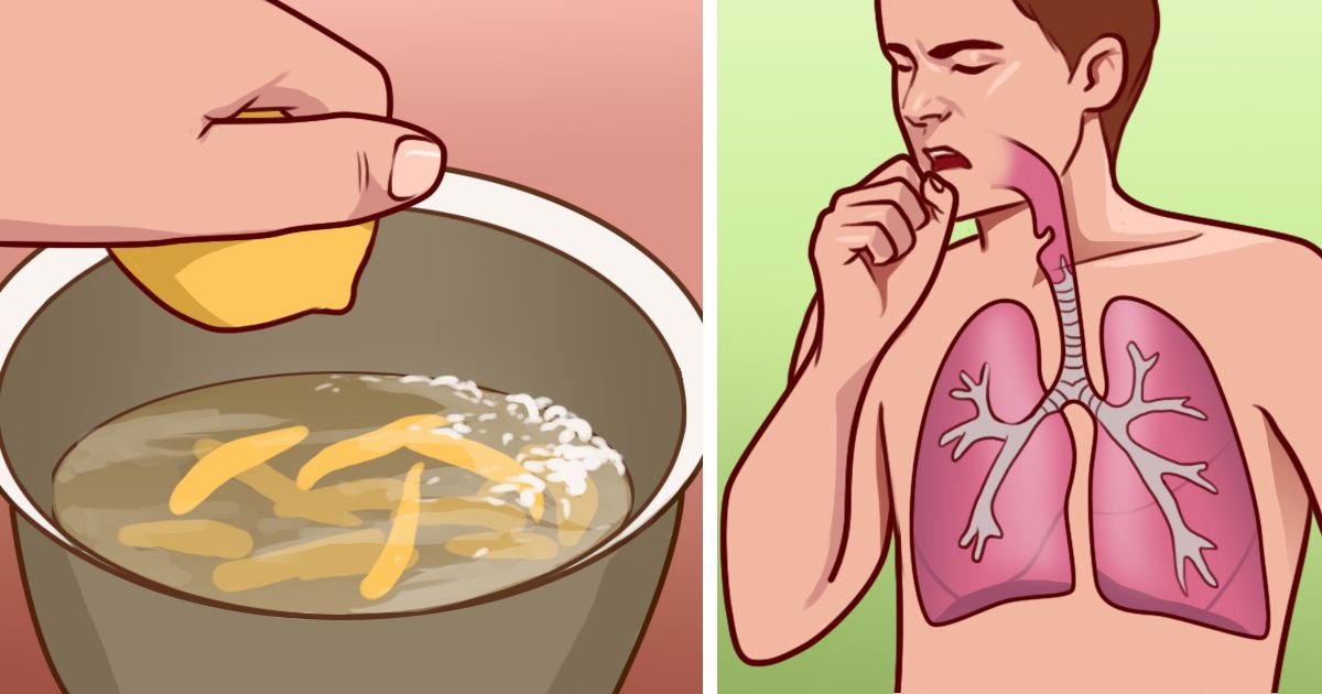 Try this natural home remedy for treating Bronchitis and stop the annoying cough attacks!