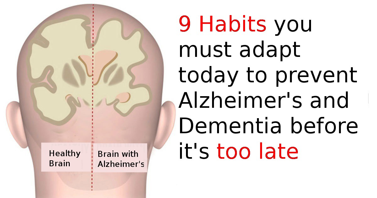 9 Habits you must adapt to prevent Alzheimer's and Dementia before it's too late