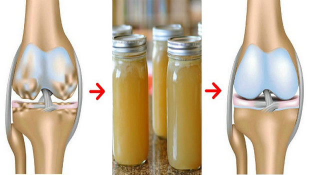 Even the doctors are amazed! This natural recipe strengthens and rehabilitates bones, knees and joints