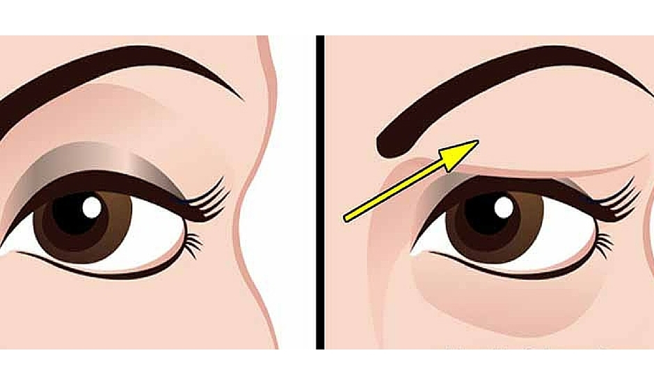 How to treat drooping eyelids naturally. The results are amazing!