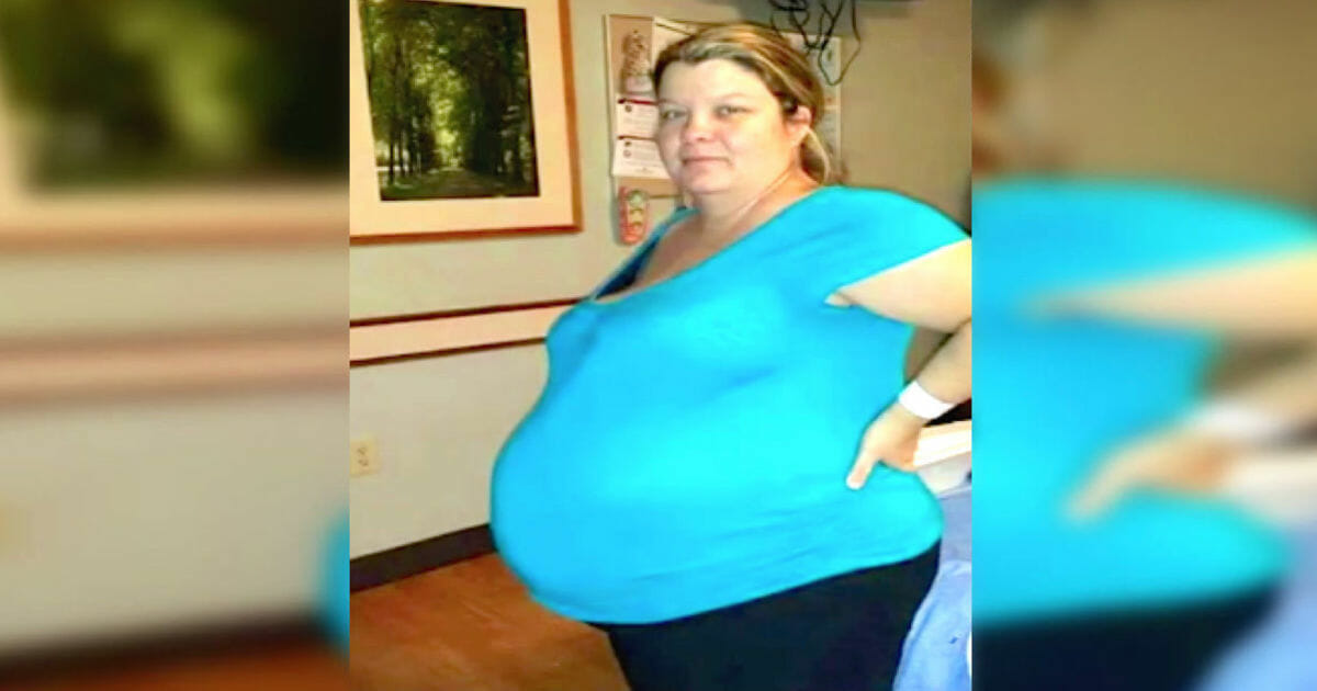 A woman thought she was pregnant, but when the doctors looked at her stomach they realized the unbelievable for her husband