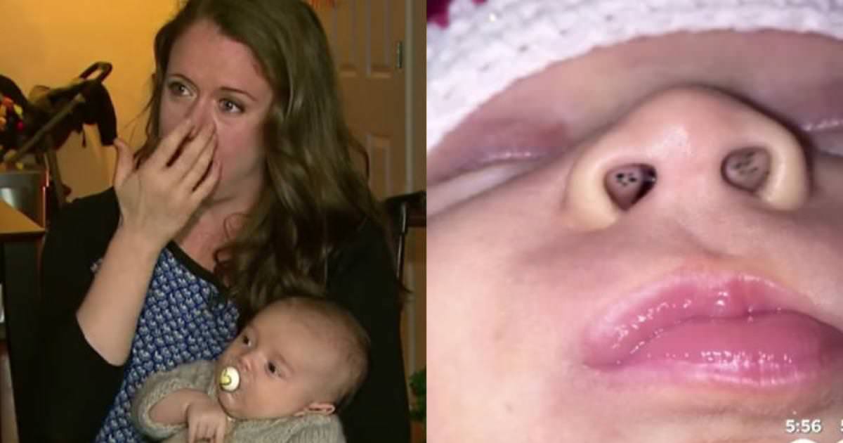 Mother noticed strange black spots inside her baby boy's nose - and then she discovered the scary truth
