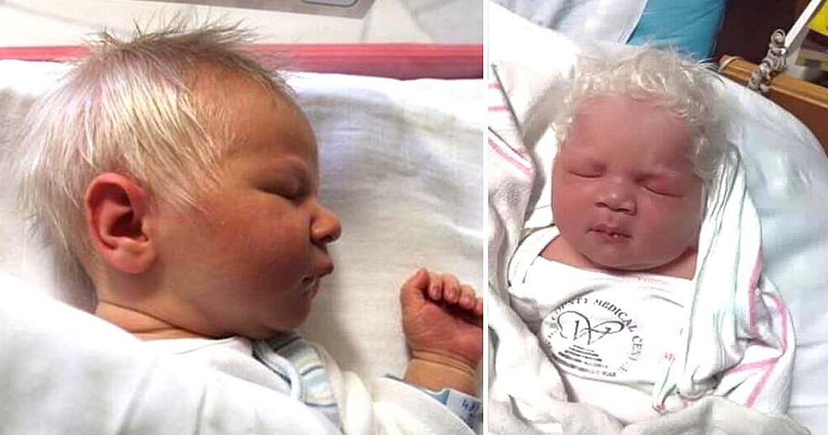 A baby was born with snow-white hair, when the doctors told the mother the reason, she was left speechless