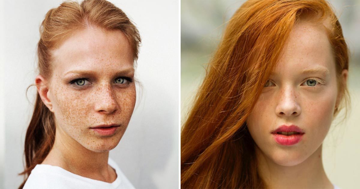 People laughed at them because they were redheads, but what this photographer documented changed everything!
