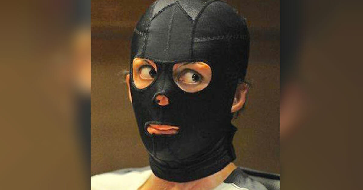 A woman survived severe burns - two years later she removed the mask and revealed her huge secret