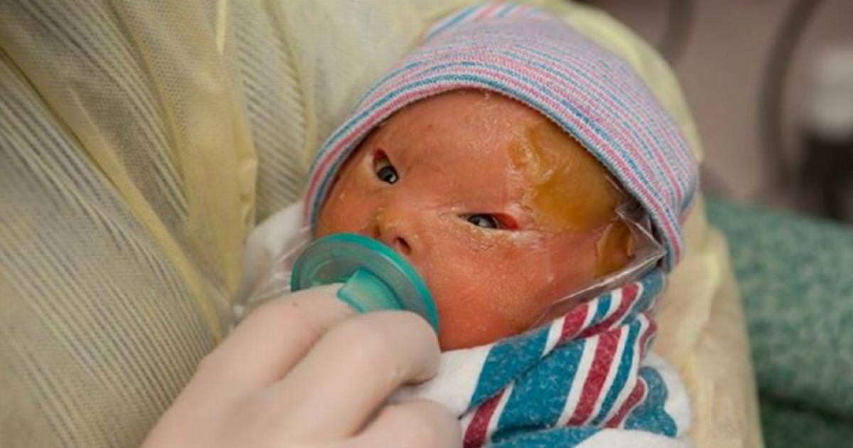 Mother was shattered in pieces when she saw her baby in the delivery room: two weeks later they realized she was a miracle