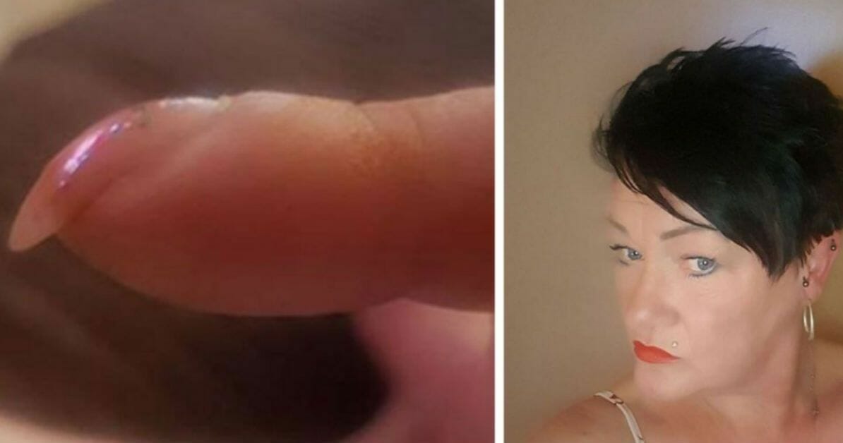 A Mom posted picture of her nails on social media - immediately received messages urging her to go to a doctor