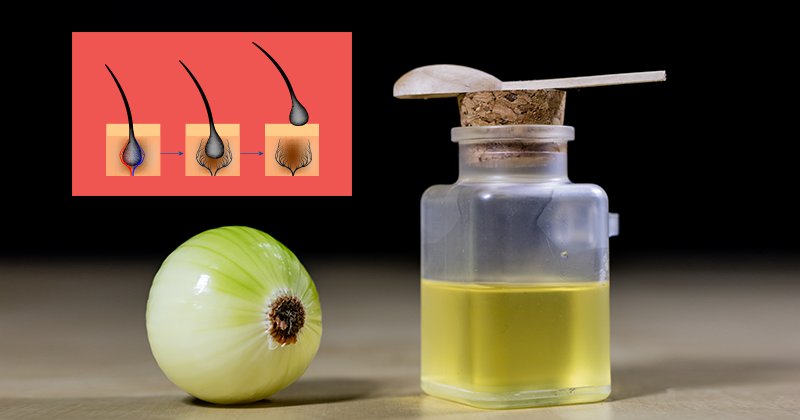 A recipe for making onion water for growing and strengthening the hair!