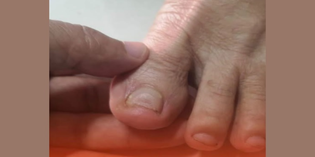 Doctors reveal: two 'silent killers' in your feet you can't ignore