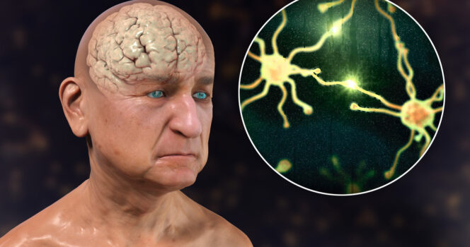 10 early signs of dementia you shouldn't ignore - and the habits you should start today